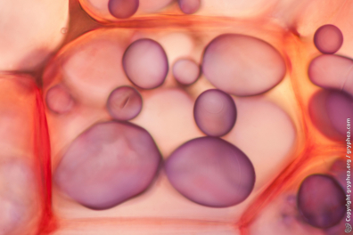 Cellule de tubercule de Pomme de terre montrant des amyloplastes x100